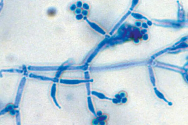How to use Trichoderma to protect home plants from root diseases and promote better growth |