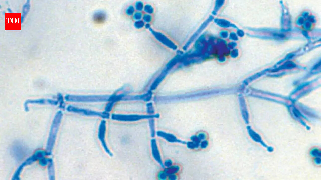 How to use Trichoderma to protect home plants from root diseases and promote better growth |