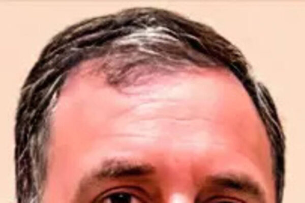 Sharp inflation in offing after assembly polls, alleges Rahul | India News