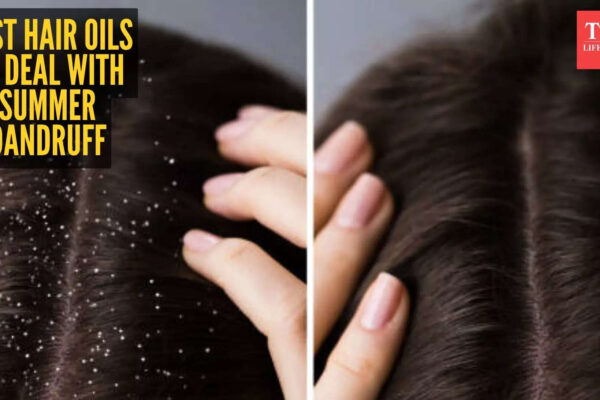 5 hair oils to beat summer dandruff