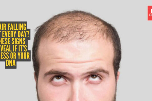 Stress or genetics? The real cause of your hair fall revealed