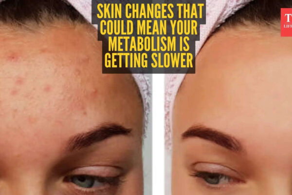 5 skin signs that your Metabolism is slowing down