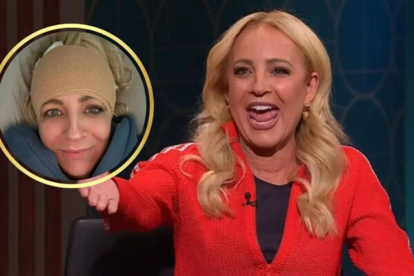 Carrie Bickmore Reveals Need for Plastic Surgery After Serious Head Injury |