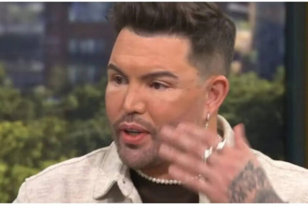 Bobby Norris Health Scare: Bobby Norris reveals ‘life-threatening’ health scare led to dramatic face and neck lift: ‘Tomorrow isn’t guaranteed’ |