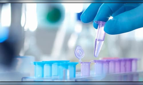 Alembic Pharma shares gain after drugmaker gets USFDA approval for cancer treatment drug