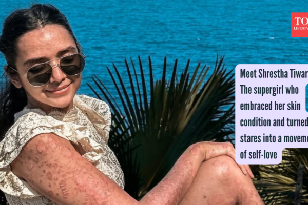 Meet Shrestha Tiwari: The supergirl who embraced her skin condition and turned stares into a movement of self-love |