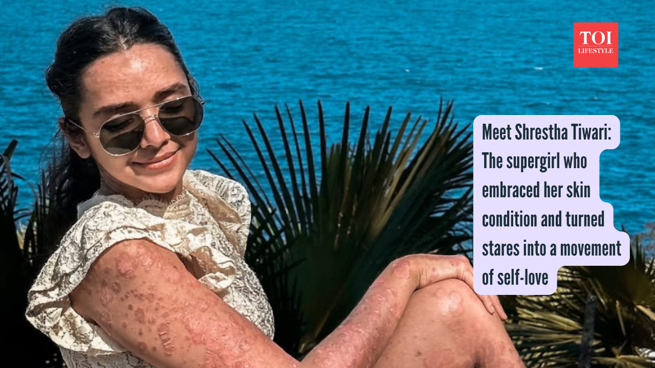 Meet Shrestha Tiwari: The supergirl who embraced her skin condition and turned stares into a movement of self-love |