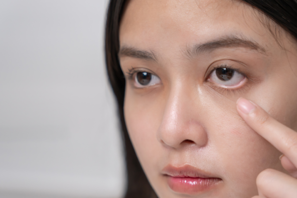 Puffy eyes that won’t go away? Why it could signal kidney trouble, and when to get tested