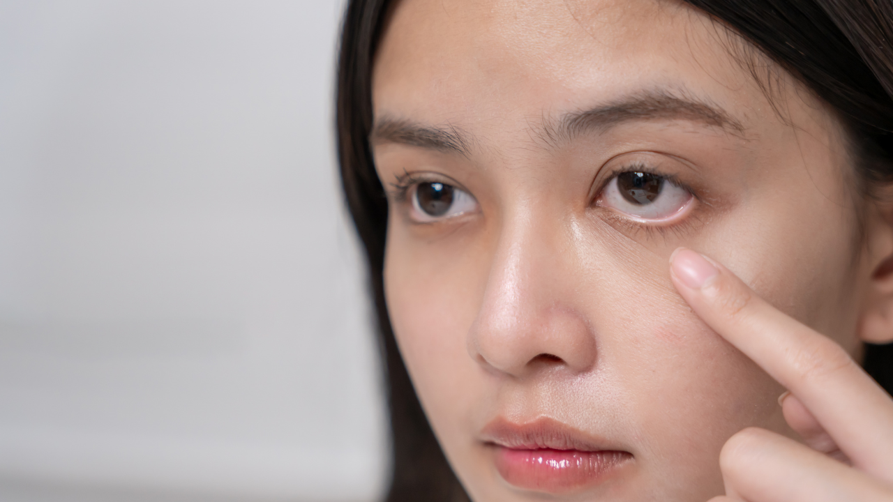 Puffy eyes that won’t go away? Why it could signal kidney trouble, and when to get tested