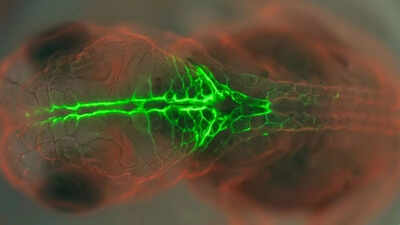 PRICKLE1 protein study uses glowing embryos to understand birth defects |