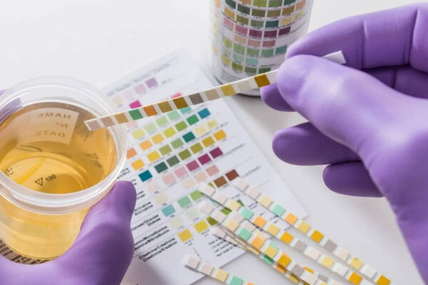 Your urine colour could be warning you about hidden health problems, what every shade really means