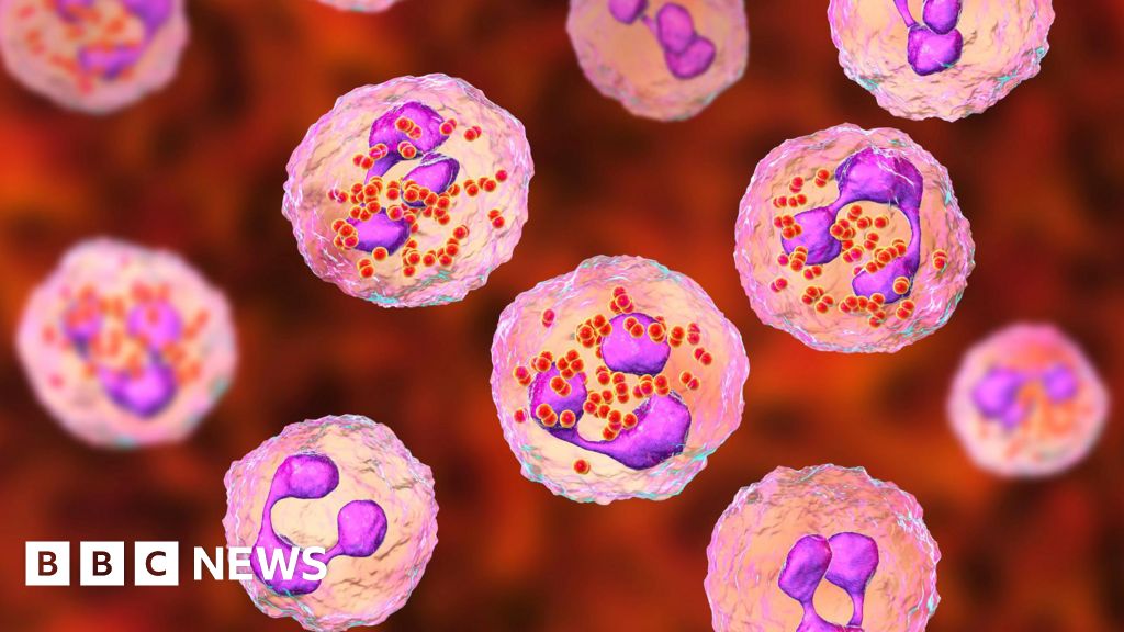 One dead and two ill after meningitis cases in Reading