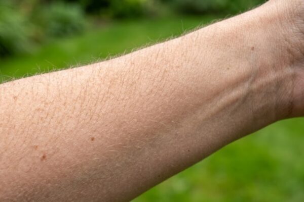Why arm hair stops growing but head hair keeps getting longer |