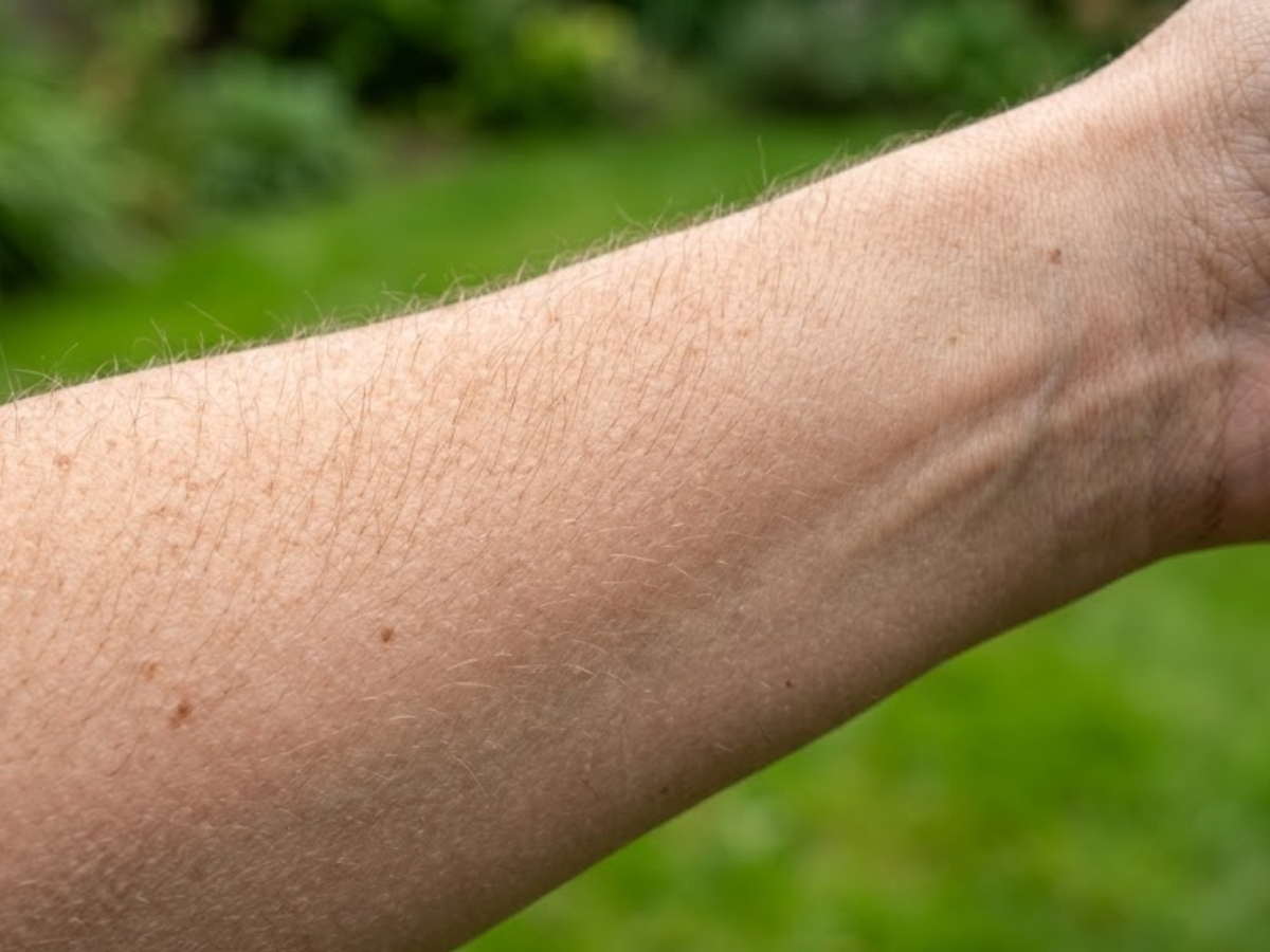 Why arm hair stops growing but head hair keeps getting longer |