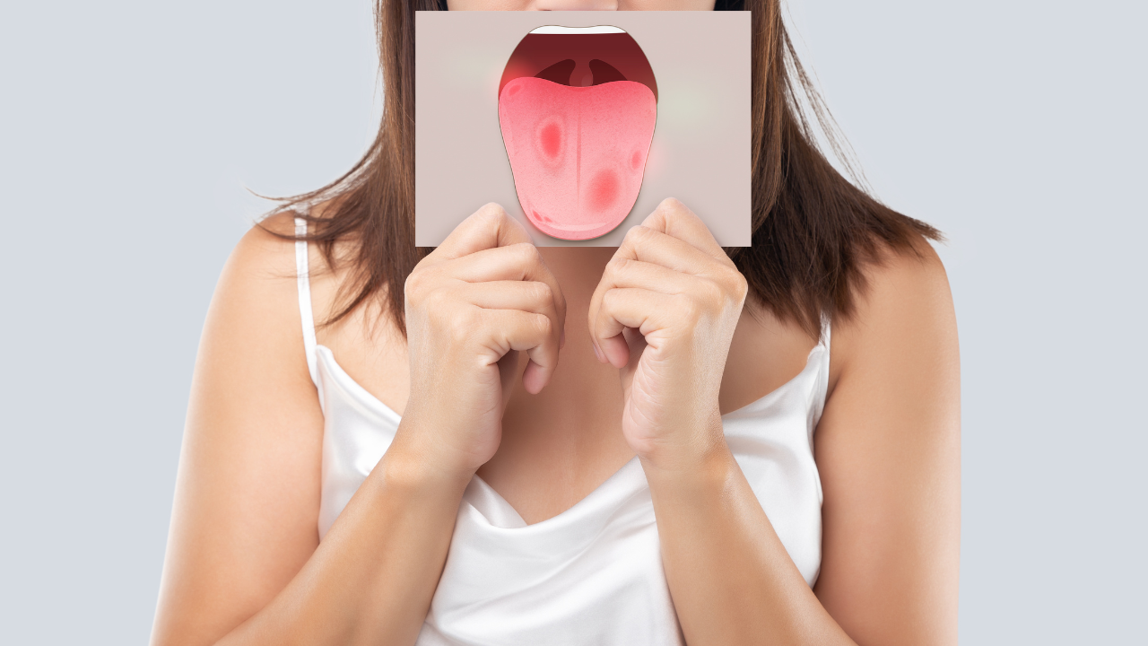 What your tongue colour may reveal about your health