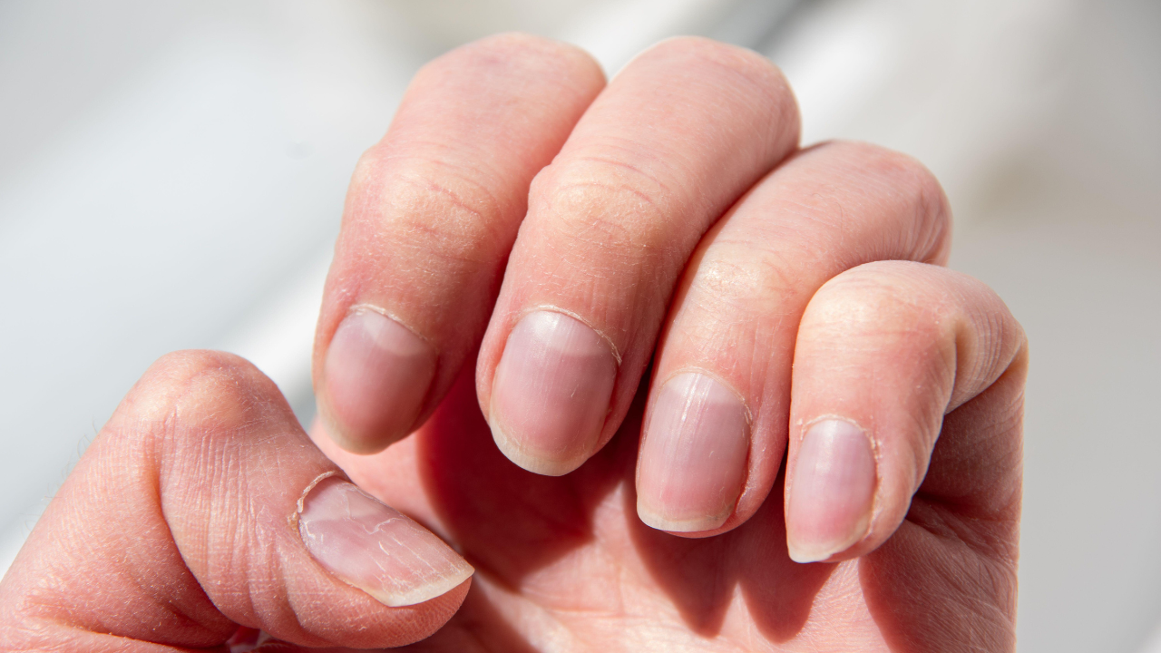 What your fingernails may reveal about health