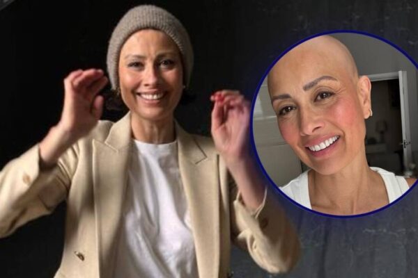 Melanie Sykes reveals her bald look, following the diagnosis of Alopecia: 'Loss + Gain = Life |