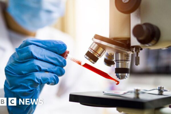 Brazil monitors two patients for possible Ebola infection