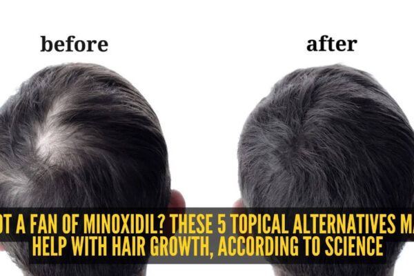 5 topical minoxidil alternatives to increase hair growth