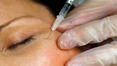 Zombie filler: Dead people's fat is the latest beauty trend