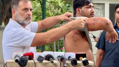 'His eye suffered damage': Rahul Gandhi brings alleged pellet gun victim before media, renews call to sack Pradhan | India News