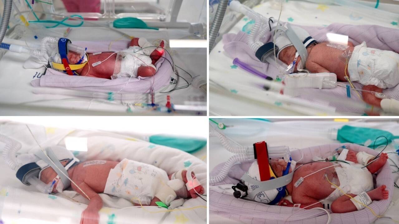 Australian woman gives birth to rare identical quadruplet girls after naturally conceived pregnancy |
