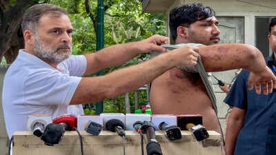'Who approved pellet guns?' Rahul Gandhi writes Amit Shah over 'barbaric assault' on students | India News