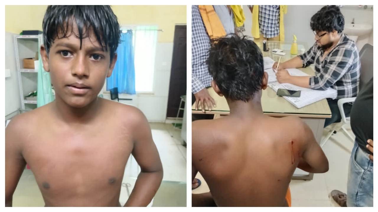 He jumped into a canal to escape a wild boar, but it followed him in: How a 14-year-old in Odisha wrestled the animal for 90 minutes
