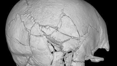 A skeleton found beneath Scotland's Stirling Castle had more than 160 fractures; researchers say it is the first confirmed death from a trebuchet