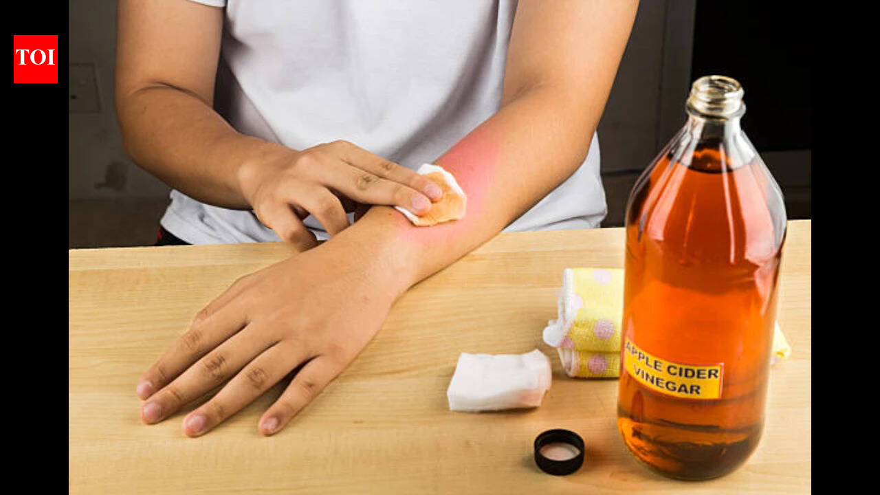Is it safe to remove moles with apple cider vinegar?