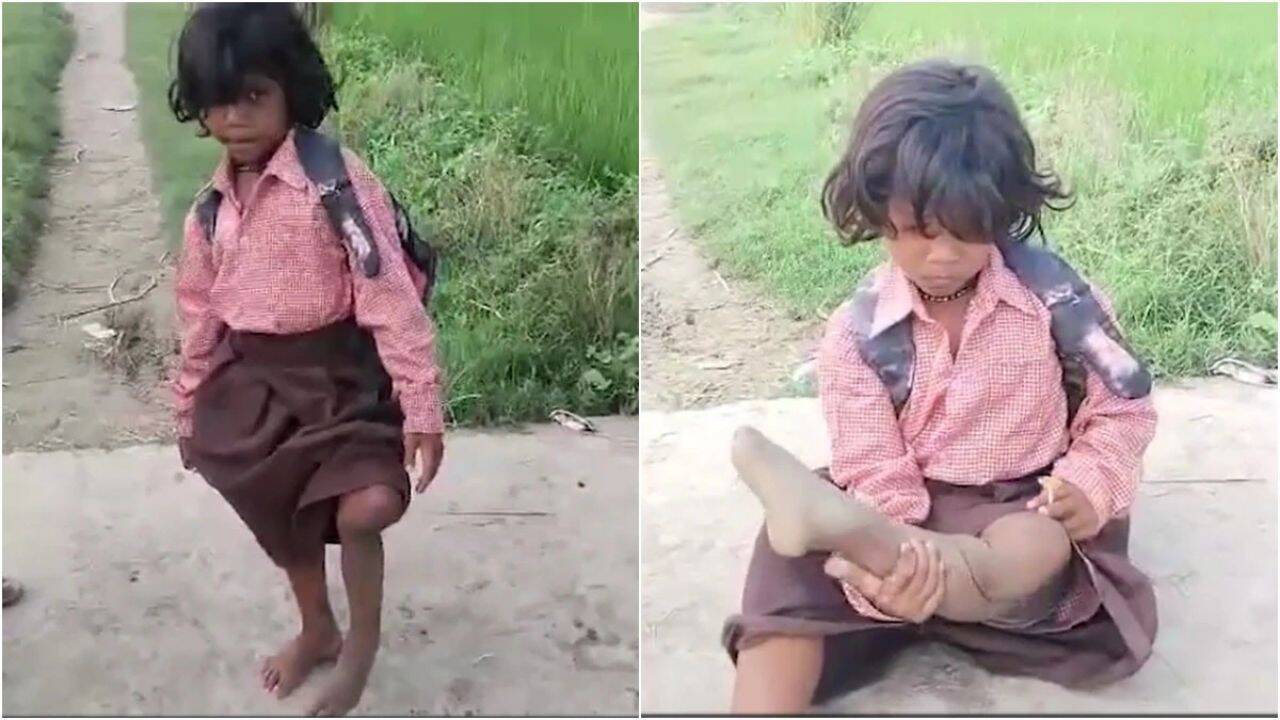 She lost her leg, but not her will to learn: 7-year-old Ragini’s daily hop to school ended with a bicycle from the DM |